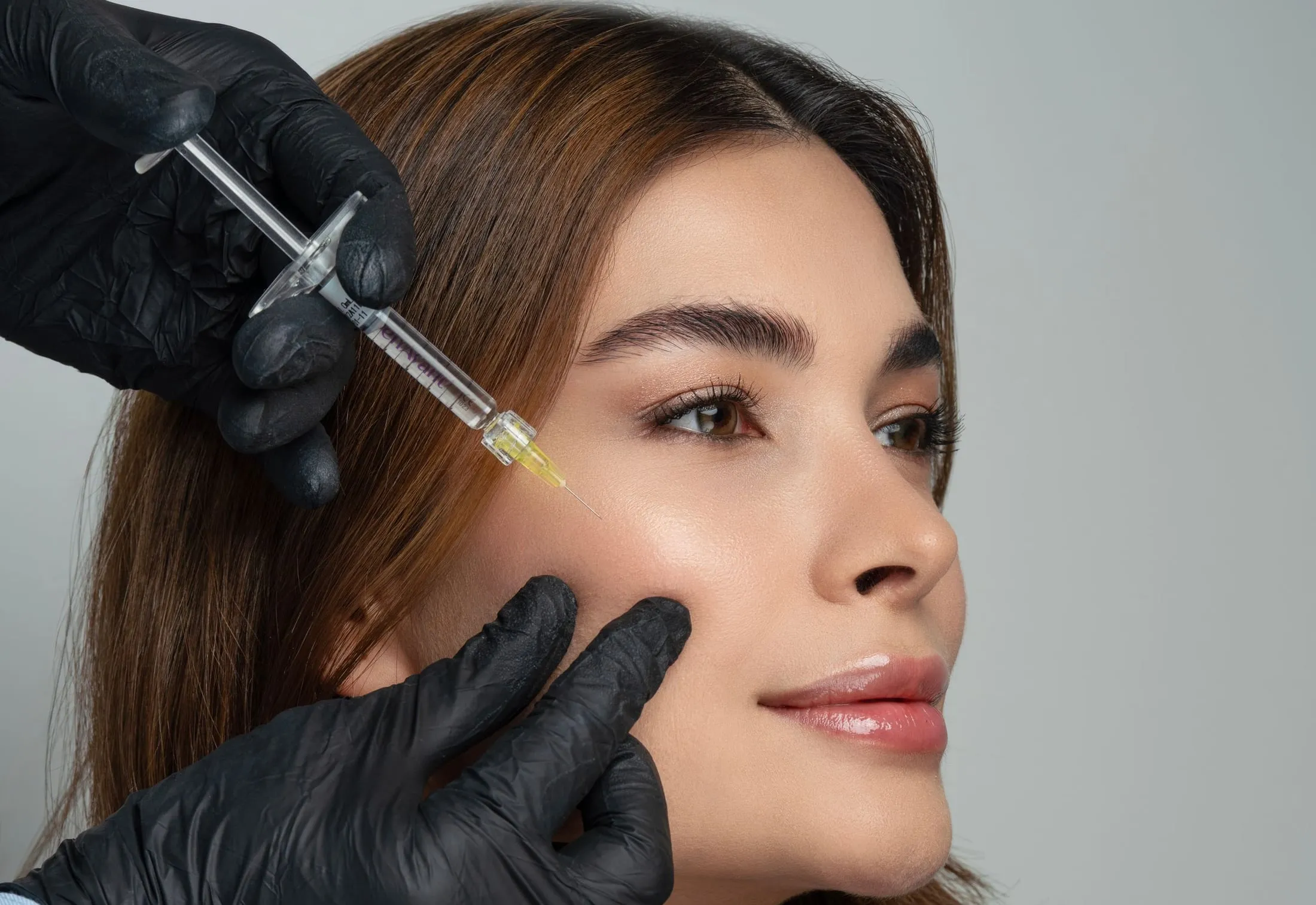 Gloved clinician injecting a collagen biostimulator into a client’s midface at Skincredible Wichita