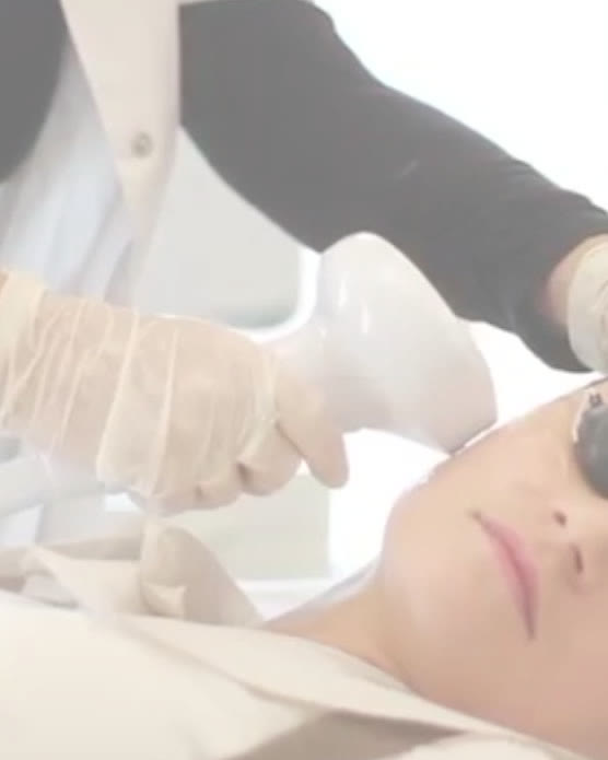 Before and after Lumecca IPL photofacial sun damage results Wichita